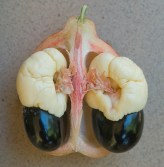 Akee fruit by Rik Schuiling (CC 3.0)